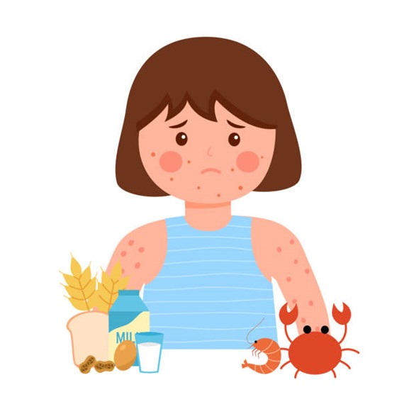 A cartoon drawing of a child with food items representing allergies.